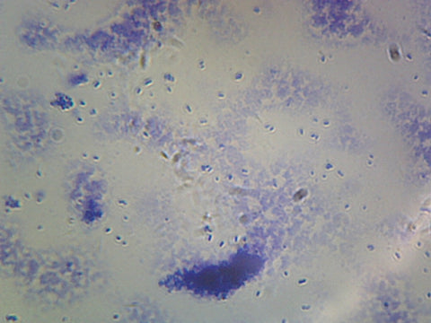 Clostridium Perfringens; Smear; Gram-Positive by Go Science Crazy