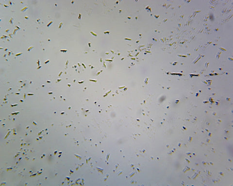 Clostridium Botulinum, Spore-Forming Anaerobic Rods; Smear; Gram-Positive by Go Science Crazy