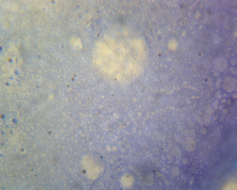 Mycobacterium Tuberculosis; Smear; Gram-Positive by Go Science Crazy