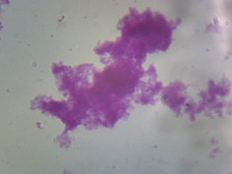 GSC International PS0309 Neisseria Gonorrhoeae; Smear; Gram-Negative