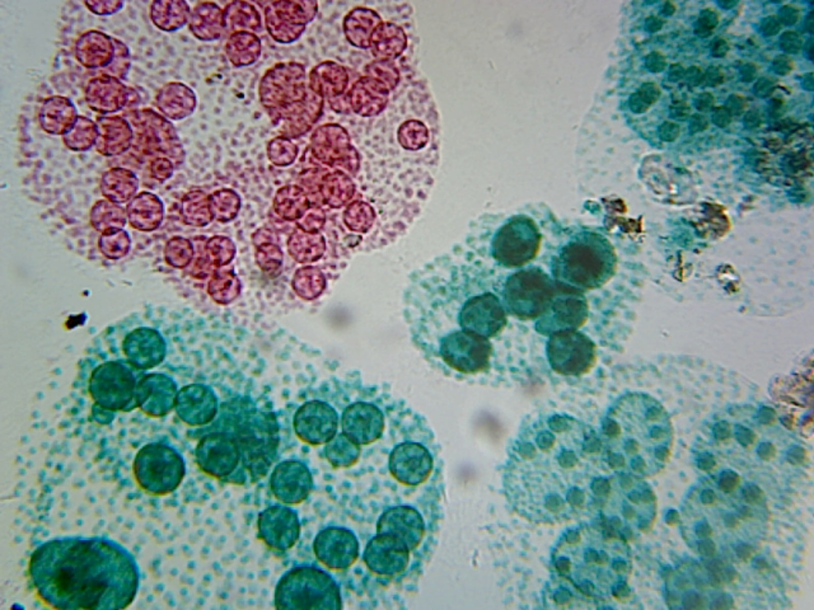 Microscope Slide, Volvox, Asexual, Reproduction W.M. Colonial Algae showing  Daughter Colonies