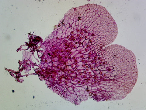 Fern (Pteridophyta) Prothallium, Showing Gametophytes; Cross Section by Go Science Crazy