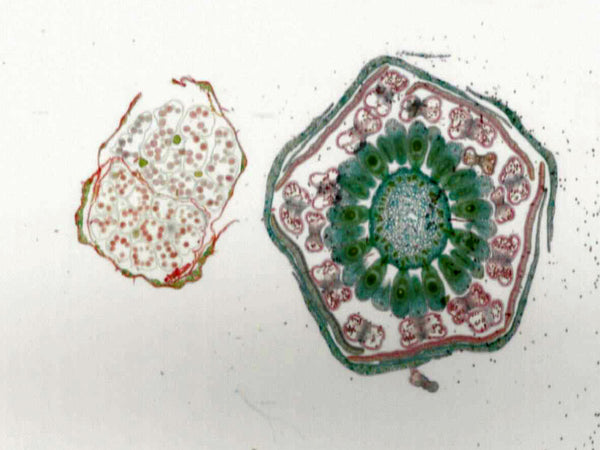 Monocot (Lily) and Dicot (Buttercup) Flower Buds Comparison; Cross Sec