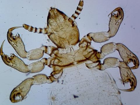 GSC International PS0428 Pediculus Humanus Capitis, Female; Whole-mount