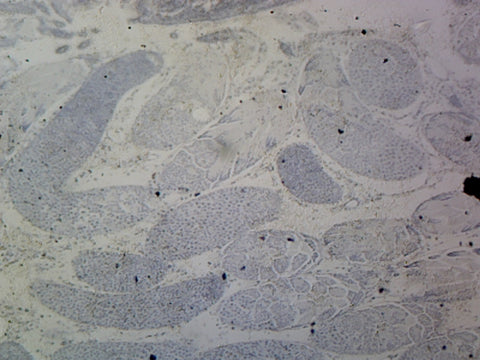 Grasshopper Testis; Whole-mount; IH Stain by Go Science Crazy