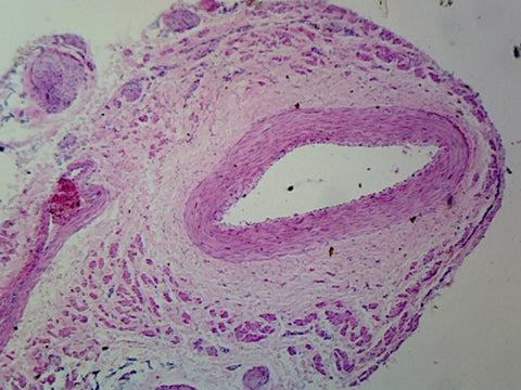 Medium-Sized Artery and Vein, Mammalian; Cross Section by Go Science Crazy