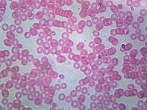 Human Blood; Smear; H&E Stain by Go Science Crazy