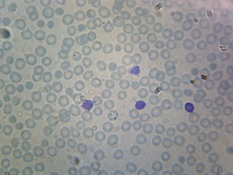 GSC International PS0129 Human Blood; Smear; WR Stain