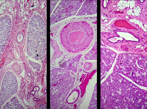 GSC International PS0161 Mammalian Salivary Glands Composite; Showing Sublingual, Submaxillary, and Parotid Gland; Sections; H&E Stain