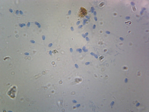 GSC International PS0165 Sperm, Mammalian; Smear