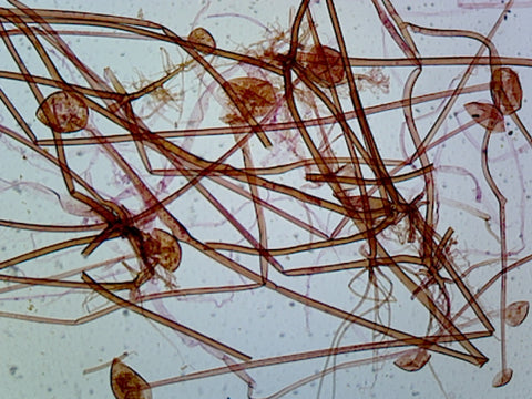 Rhizopus Sexual Reproduction, Conjugation (Showing Zygotes); Whole-mount by Go Science Crazy